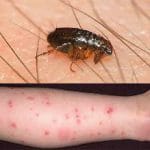 Fleas Bite — Pest Experts in Torquay Hervey Bay, QLD